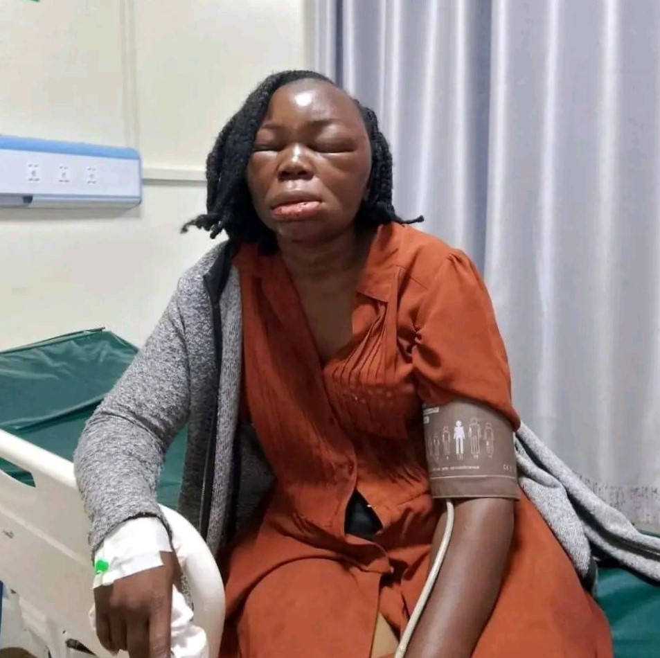 Woman Critically Injured in Suspected Domestic Attack in Bungoma County